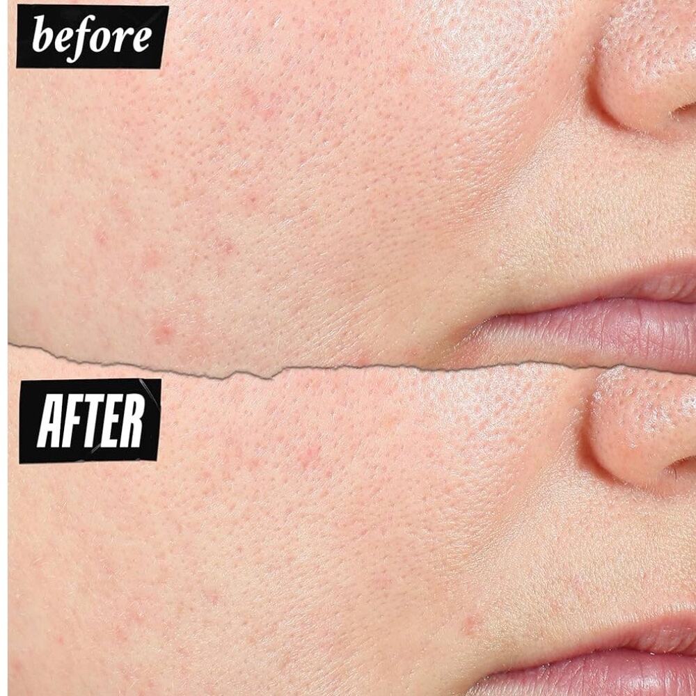 KIEHL'S Expertly Clear Acne-Treating & Preventing Lotion NWT - Picture 10 of 10